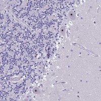 Anti-NOC2L antibody produced in rabbit 