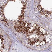 Anti-NODAL antibody produced in rabbit 