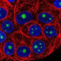 Anti-NOP16 antibody produced in rabbit 