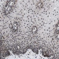 Anti-NOP58 antibody produced in rabbit 