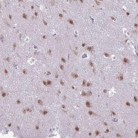 Anti-NOVA2 antibody produced in rabbit 