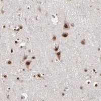 Anti-NPAS3 antibody produced in rabbit 