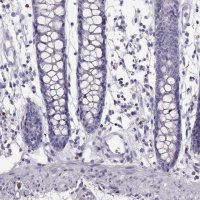 ANTI-NPTXR antibody produced in rabbit 
