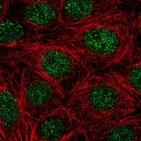 Anti-NR4A1 antibody produced in rabbit HPA059742-100UL