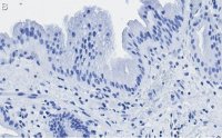 Anti-Nrf2 Antibody, clone 5B20 ZooMAb Rabbit Monoclonal 