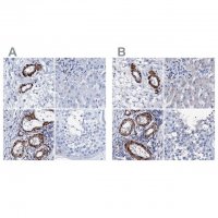 Anti-NRIP2 antibody produced in rabbit 