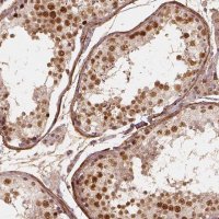 Anti-NSD2 antibody produced in rabbit 