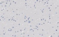 Anti-Nuclei Antibody, clone 3E1.3 ZooMAb Mouse Monoclonal 