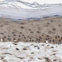 Anti-NUDCD3 antibody produced in rabbit 