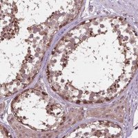Anti-NUDT1 antibody produced in rabbit 