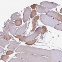 Anti-NUDT8 antibody produced in rabbit 