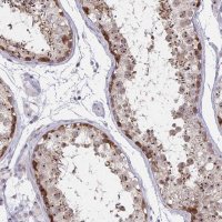 Anti-NUP85 antibody produced in rabbit 