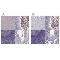 Anti-ODF3 antibody produced in rabbit 