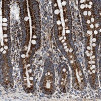 Anti-OGDH antibody produced in rabbit 