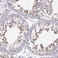 Anti-OIP5 antibody produced in rabbit HPA059602-100UL