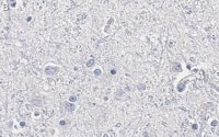 Anti-Olig2 Antibody, clone 211F1.1 ZooMAb Mouse Monoclonal 