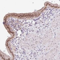 Anti-ONECUT2 antibody produced in rabbit 