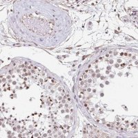 Anti-ORC3 antibody produced in rabbit 