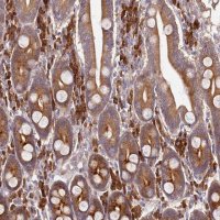 Anti-OSBPL2 antibody produced in rabbit 