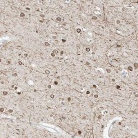 Anti-OSBPL7 antibody produced in rabbit 