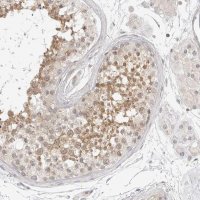 Anti-OSCP1 antibody produced in rabbit 