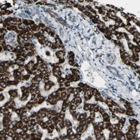 Anti-OSTM1 antibody produced in rabbit 