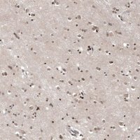 Anti-OTUB1 antibody produced in rabbit 