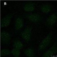 Anti-p-Ubiquitin (pSer65) Antibody, clone 2N21 ZooMAb Rabbit Monoclonal 