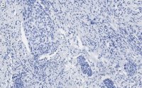 Anti-p16-INK4a Antibody, clone 5F22 Antibody, ZooMAb Rabbit Monoclonal 