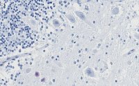 Anti-p27 Kip1 Antibody, clone 1B10 ZooMAb Rabbit Monoclonal 