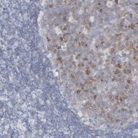 Anti-P2RY8 antibody produced in rabbit 