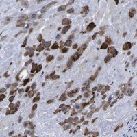 Anti-P3H1 antibody produced in rabbit 