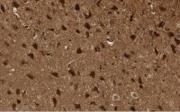 Anti-p44 MAPK (ERK1) Antibody, clone 13F10, ZooMAb Rabbit Monoclonal 