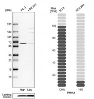 Anti-P4HA1 antibody produced in rabbit 