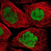 Anti-p53 antibody produced in rabbit 