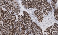 Anti-p53 Antibody, clone 6O23, ZooMAb Rabbit Monoclonal 