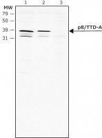 Anti-p8/TTD-A (C-terminal) antibody produced in rabbit 
