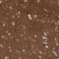Anti-PACS1 antibody produced in rabbit 