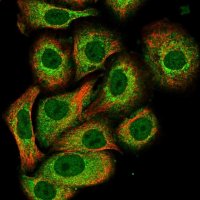 Anti-PADI3 antibody produced in rabbit 