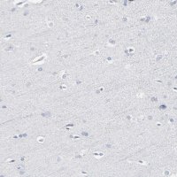 Anti-PAGE1 antibody produced in rabbit 