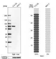 Anti-PAK1 antibody produced in rabbit 