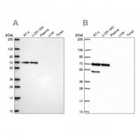 Anti-PAK4 antibody produced in rabbit 