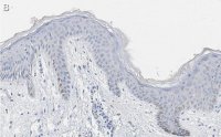 Anti-pan-cytokeratin Antibody, clone AE1 ZooMAb Mouse Monoclonal 