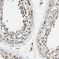 Anti-PANK2 antibody produced in rabbit HPA008440-100UL