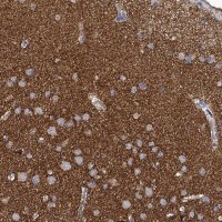 Anti-PANX2 antibody produced in rabbit 