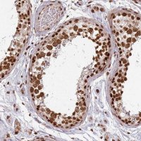 Anti-PAPD7 antibody produced in rabbit 