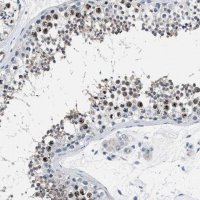 Anti-PARG antibody produced in rabbit 