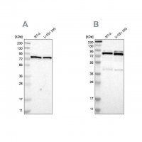 Anti-PARN antibody produced in rabbit HPA012010-100UL