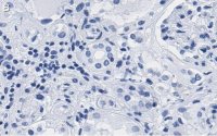 Anti-PARP-1 Antibody, clone 12N17 Antibody, ZooMAb Rabbit Monoclonal 