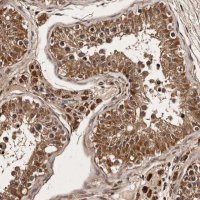 Anti-PARS2 antibody produced in rabbit HPA028314-100UL
